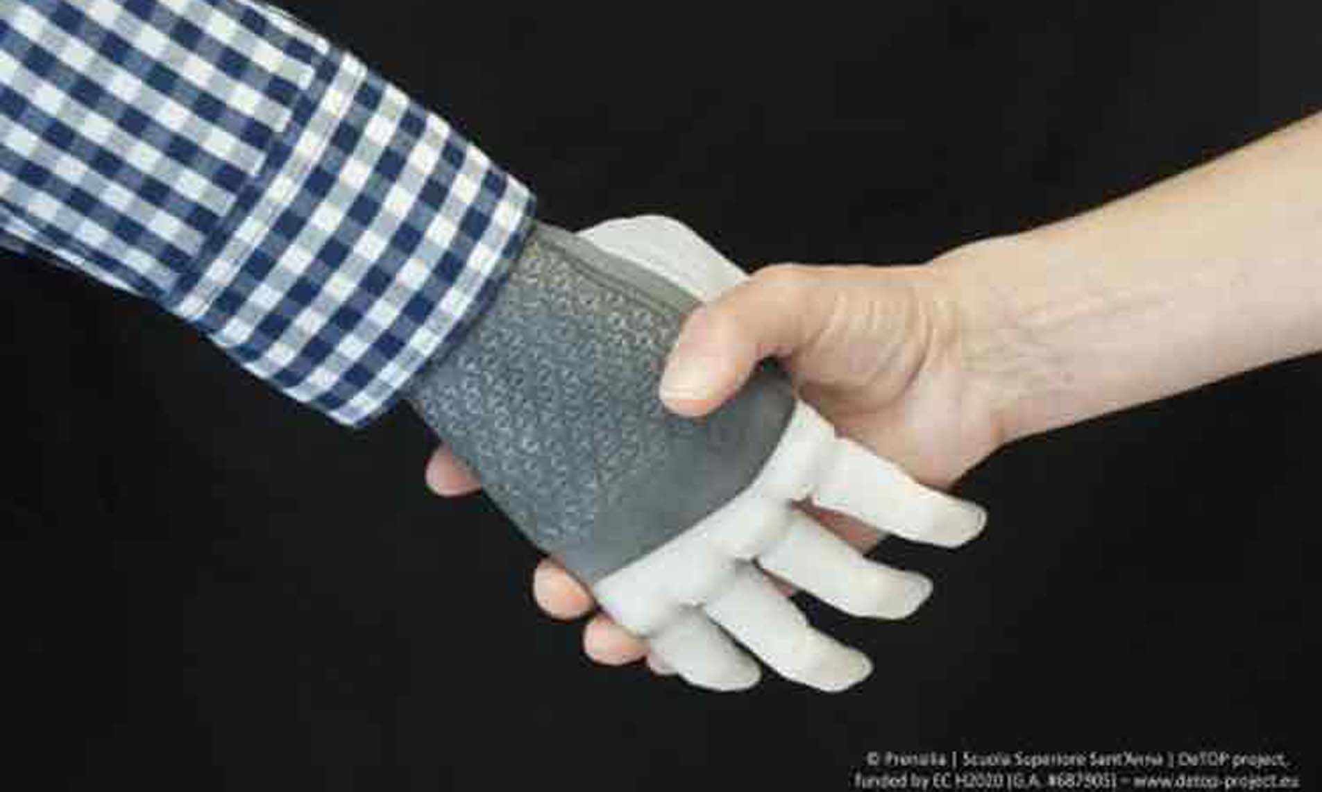 Realizan implante de una mano robótica
