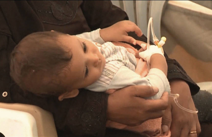 Cólera en Yemen podría llegar a más de 300 mil casos